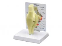 基础膝关节半月板模型