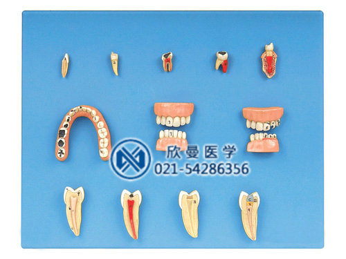 牙齿病变系列模型