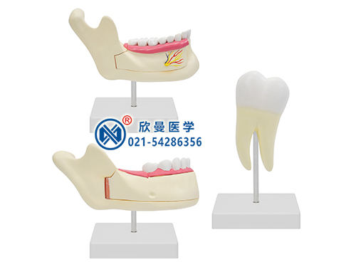 磨牙乳牙恒牙模型