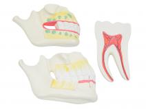 乳牙、恒牙牙列模型