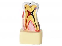 牙齿综合病理模型