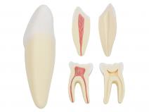 人体牙齿解剖放大模型（切牙、尖牙、磨牙模型）