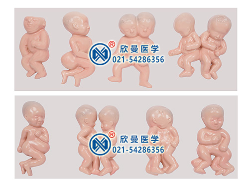 胎儿畸形模型,畸形胎儿模型