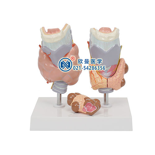 甲状腺病理模型