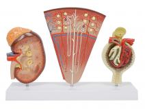 肾剖面、肾单位、肾小球模型