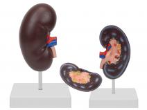 肾脏解剖模型