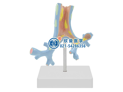 支气管病理模型