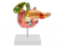 胰腺十二指肠病变模型