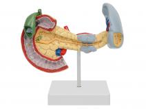 胰脾十二指肠病变模型