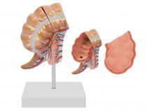 盲肠和阑尾模型